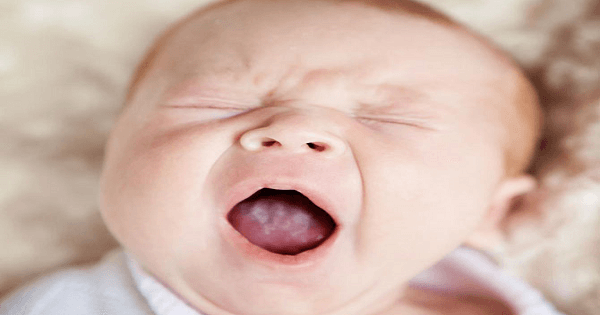 علاج فطريات اللسان عند حديثي الولادة ماميتو